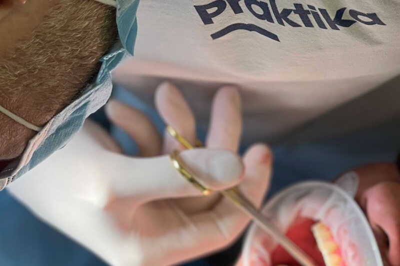 Коронки e-max