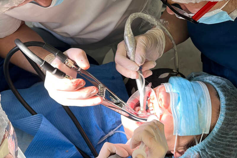 Имплантанты Neodent