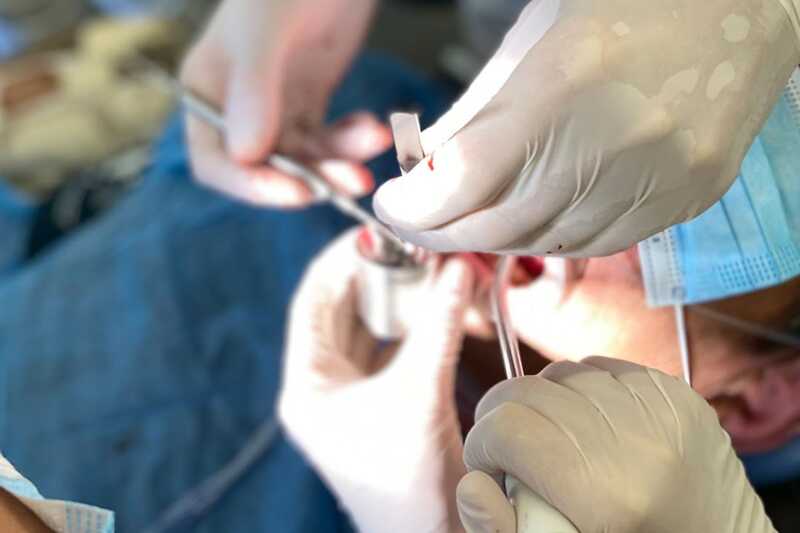 пломбирование зубов