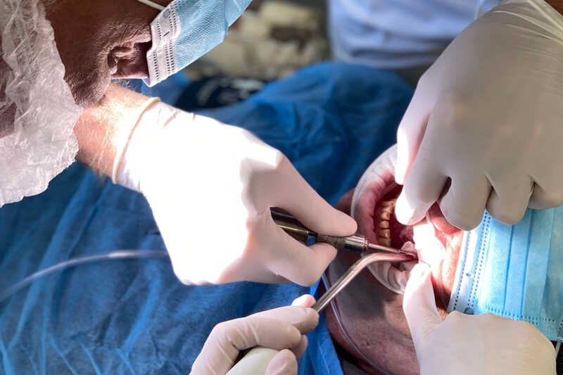 импланты Штрауман (Straumann) цены Харьков