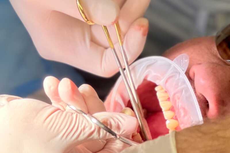 замена импланта