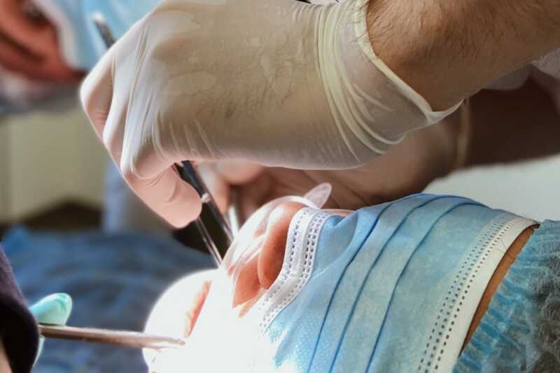 удаление зуба